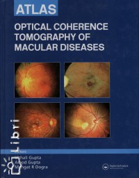 Mangat R. Dogra - Amod Gupta - Vishali Gupta - Optical Coherence Tomography of Macular Diseases