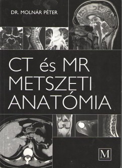Dr. Molnr Pter - CT s MR metszeti anatmia