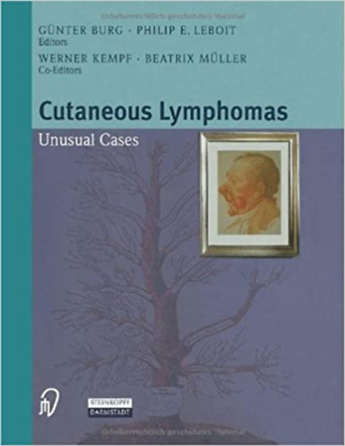 Philip E. Leboit, Werner Kempf, Beatrix M�ller G�nter Burg - Cutaneous Lymphomas - Unusual Cases