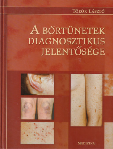 Török László - A bőrtünetek diagnosztikus jelentősége