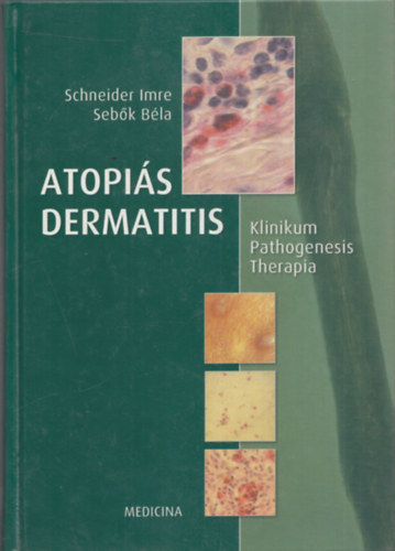 Dr. Schneidern; Dr. Sebk - Atopis dermatitis