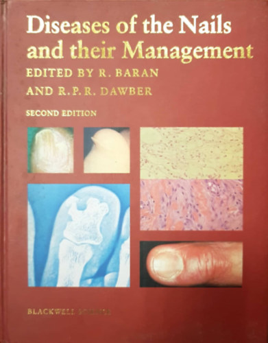 R.P.R. Dawber R. Baran - Diseases of the Nails and their Management
