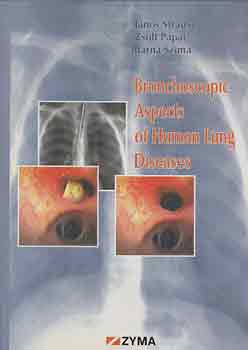 Strausz-P�pai-Szima - Bronchoscopic Aspects of the Human Lung Diseases