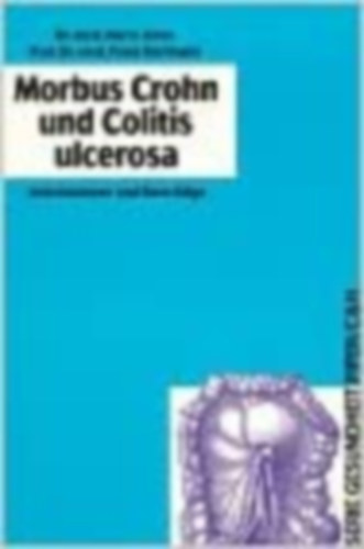 Jenss - Hartmann - Morbus Crohn und Colitis ulcerosa