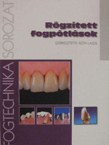 R�th Lajos  (szerk.) - R�gz�tett fogp�tl�sok