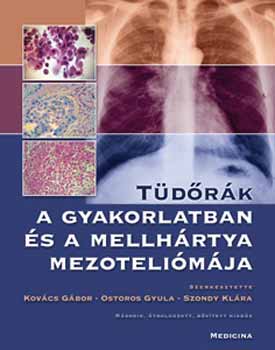 Tüdőrák a gyakorlatban és a mellhártya mezoteliómája