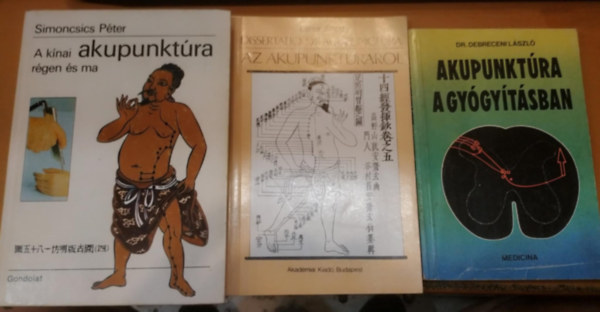 Dr. Laner Antal, Dr. Simoncsics P�ter Debreceni L�szl� - 3 db Akupunkt�ra a gy�gy�t�sban + Dissertatio de acupunctura az akupunkt�r�r�l + A k�nai akupunkt�ra r�gen �s ma