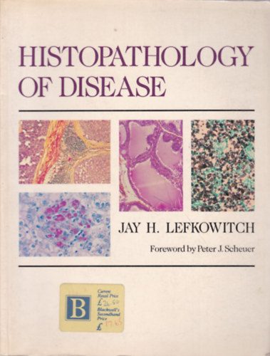 Jay H. Lefkowitch - Histopathology of Disease (Betegsgek sejtlettana - angol nyelv)