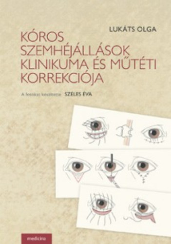 Luk�ts Olga - K�ros szemh�j�ll�sok klinikuma �s m�t�ti korrekci�ja