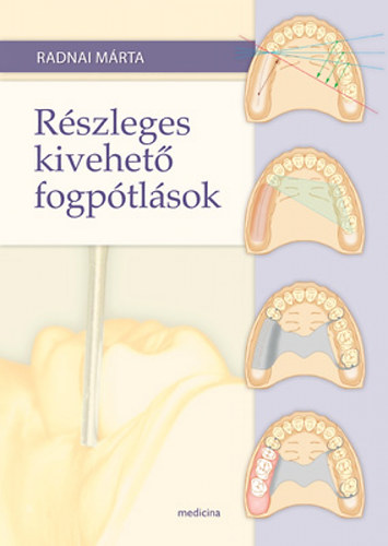 Radnai Mrta - Rszleges kivehet fogptlsok