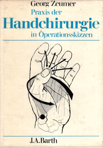 Georg Zeumer - Praxis der Handchirurgie in Operationsskizzen.
