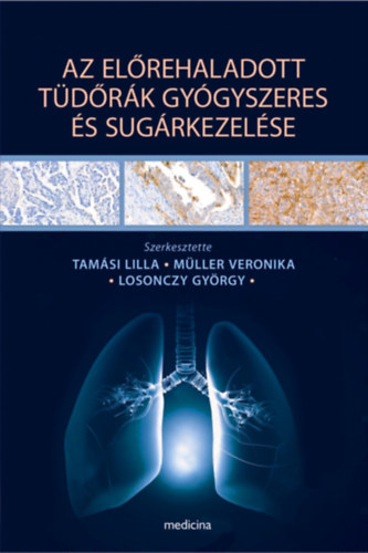 Tamsi Lilla - Mller Veronika - Losonczy Gyrgy - Az elrehaladott tdrk gygyszeres s sugrkezelse