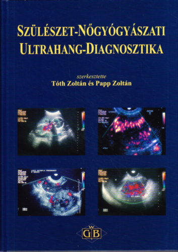 Papp Zoltn  (szerk.) Tth Zoltn (szerk.) - Szlszet-ngygyszat ultrahang-diagnosztika