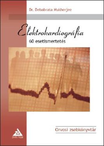 Dr. Debabrata Mukherjee - Elektrokardiográfia - 60 esetismertetés