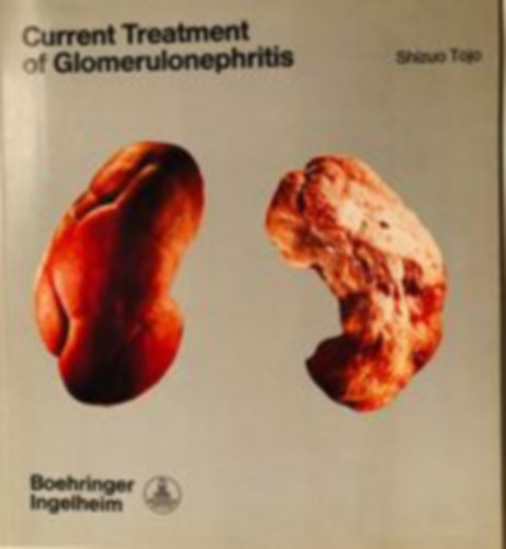 Current Treatment of Glomerulonephritis
