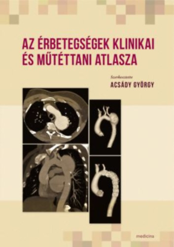 Acsdy Gyrgy; Dr. Nemes Attila - Az rbetegsgek klinikai s mtttani atlasza