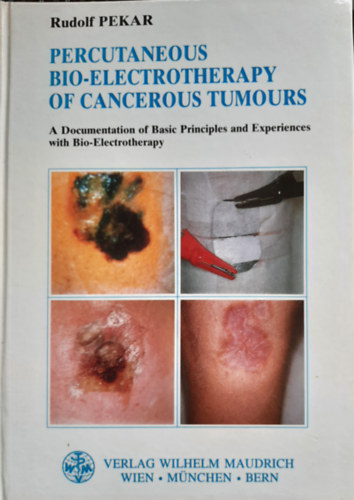 Rudolf Pekar - Percutaneous Bio-Electrotherapy of Cancerous Tumours: A Documentation of Basic Principles and Experiences with Bio-Electrotherapy