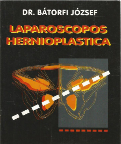 Dr. Bátorfi József - Laparoscopos Hernioplastica