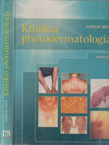 Horkay Ir�n - Klinikai photodermatologia