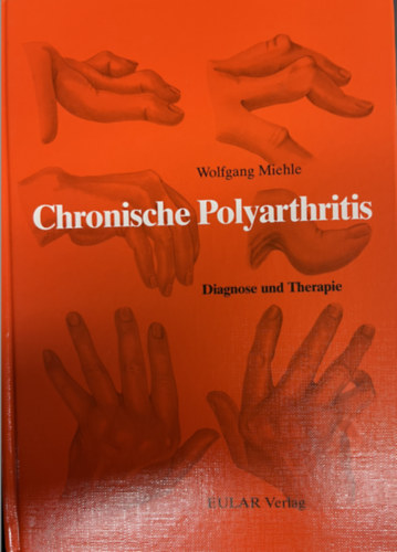 Wolfgang Miehle - Chronische Polyarthritis