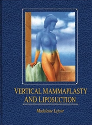 Madeleine Lejour - Vertical Mammaplasty and Liposuction