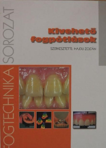 Hajdu Zolt�n  (szerk.) - Kivehet� fogp�tl�sok