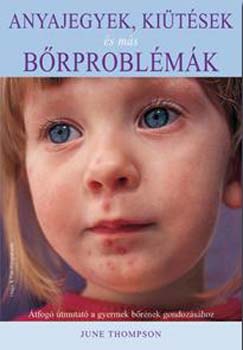 June Thompson - Anyajegyek, kitsek s ms brproblmk