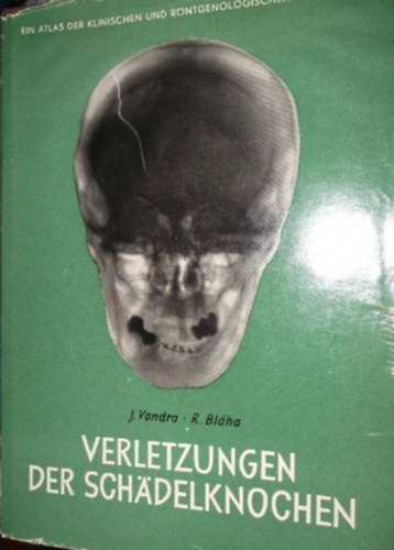 R. Bláha J. Vondra - Verletzungen der Schädelknochen