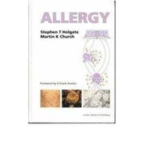 Stephen T. Holgate - Martin K. Church - Allergy (Allergia - angol nyelvű)