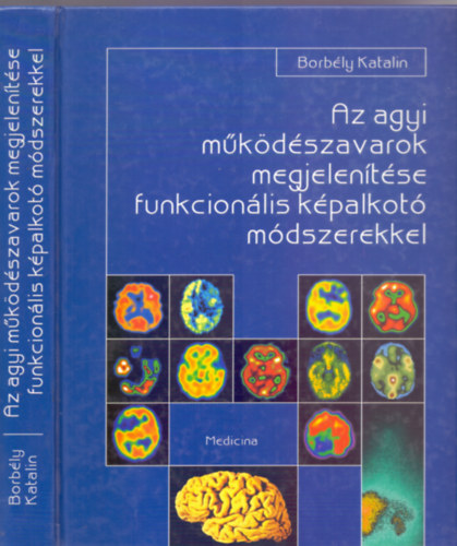 Dr. Lektor�lta: Prof. Dr. Szirmai Imre Borb�ly Katalin - Az agyi m�k�d�szavarok megjelen�t�se funkcion�lis k�palkot� m�dszerekkel (Sz�nes �s fekete-feh�r �br�kkal)