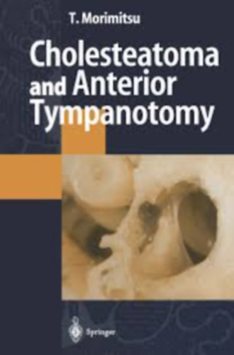 Morimitsu - Cholesteatoma and anterior tympanotomy