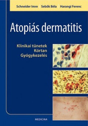 Dr. Dr. Sebők Béla, Dr. Harangi Ferenc Schneidern - Atopiás dermatitis