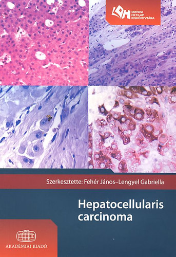 Fehr Jnos; Lengyel Gabriella - Hepatocellularis carcinoma