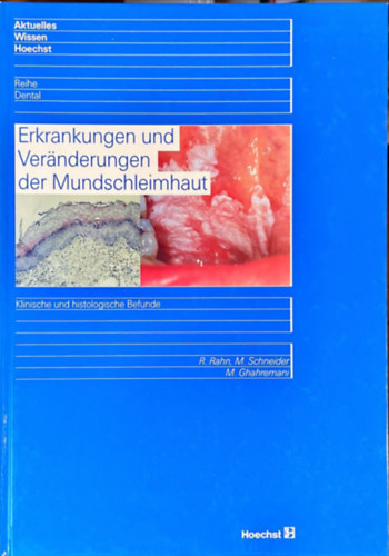 M. Schneider, M. Ghahremani R. Rahn - Erkrankungen und Ver�nderungen der Mundschleimhaut