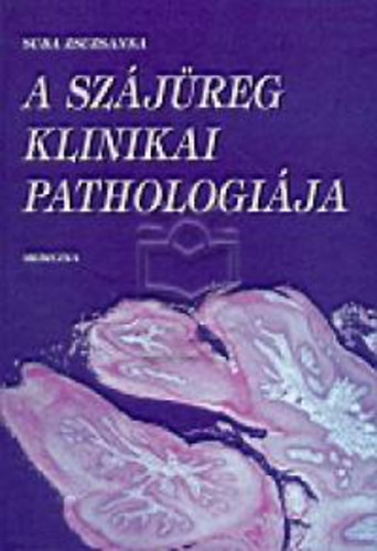 Suda Zsuzsanna - A szájüreg klinikai pathologiája