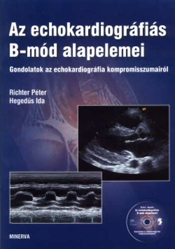 Richter Pter - Hegeds Ida - Az echokardiogrfis B-md alapelemei - Gondolatok az echokardiogrfia kompromisszumairl - CD-vel