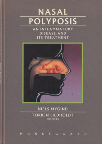 Niels Mygind - Nasal Polyposis