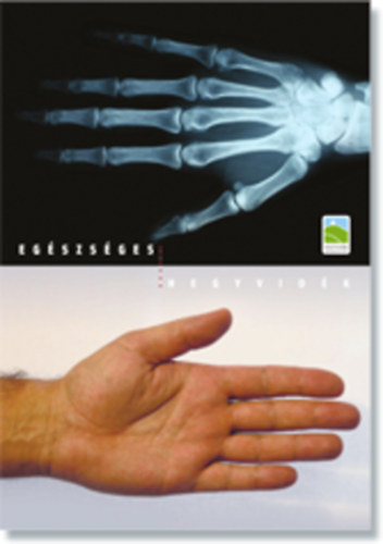 Eg�szs�ges hegyvid�k