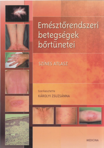 K�rolyi Zsuzs�nna - Em�szt�rendszeri betegs�gek b�rt�netei - Sz�nes atlasz